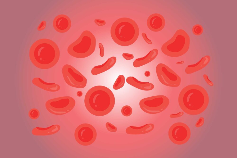 anemia-pathophysiology-diagnostic-classification-viralian